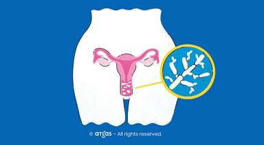 Candidoza vaginală | Insistența unei infecții fungice